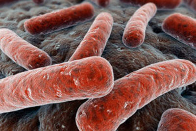 Tuberculose Tuberculose