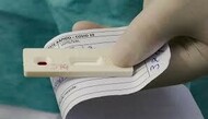 testecovid