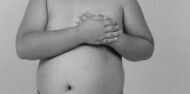 imagem-obesidade-infantil