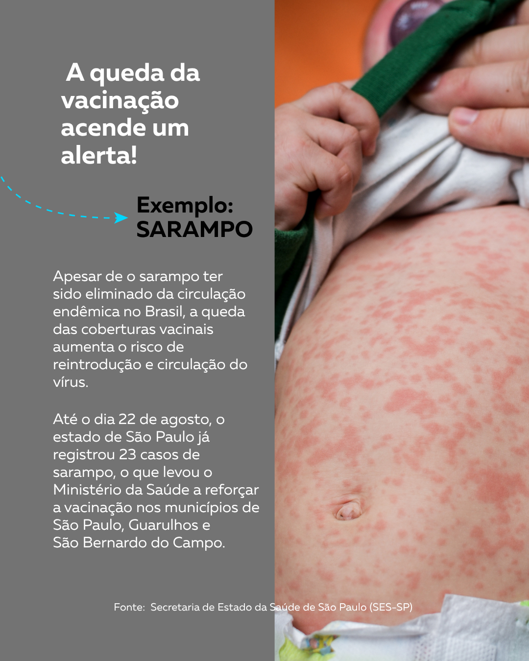  sarampo e multivacinação (3).png