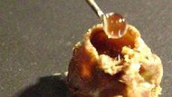 Abelha