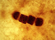 Microorganismo