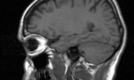 cerebro