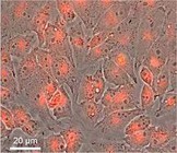 nanopontos1