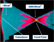 ultrassom_focal