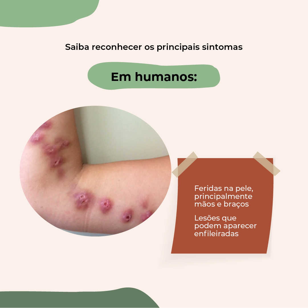  esporotricose_-_feed_(5).png