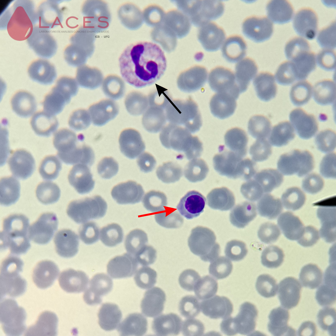 Eritroblasto ortocromático